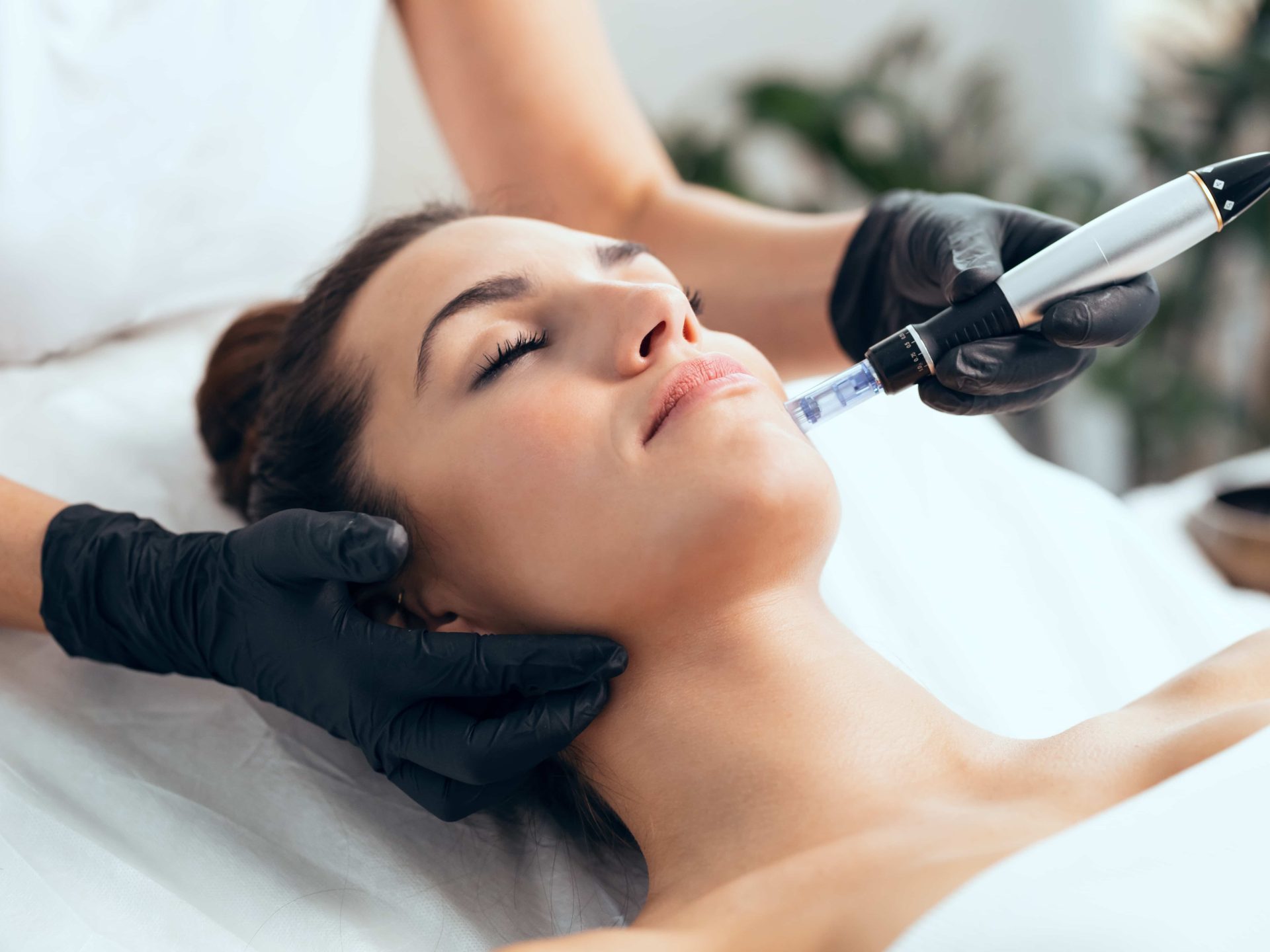 10 Benefits of Microneedling
